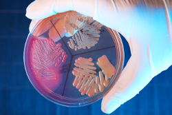 Petri dish with microbes